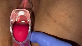 Gynecologist Uses Speculum To Stimulate Patient'S Genitalia